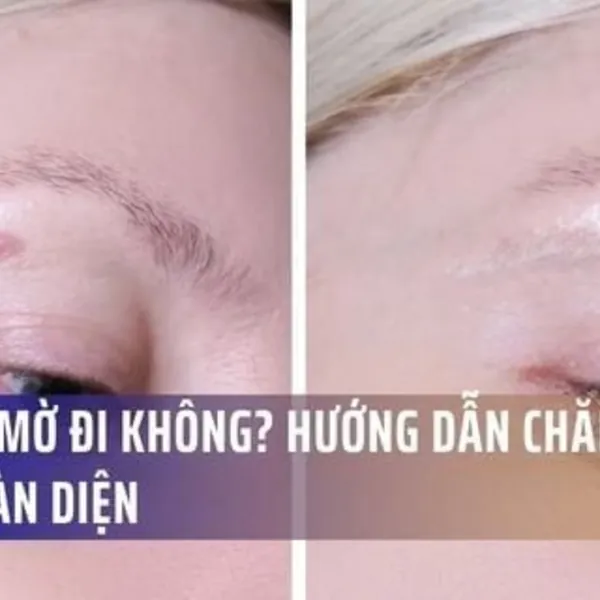 Sẹo Có Mờ Đi Không? Hướng Dẫn Chăm Sóc Sẹo Toàn Diện