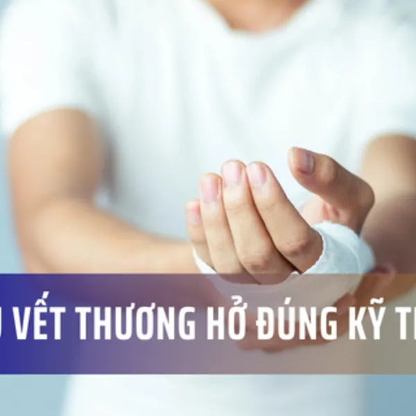 Cách sơ cứu cho vết thương hở đúng kỹ thuật