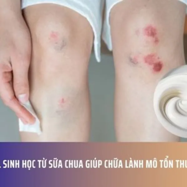Gel sinh học từ sữa chua giúp chữa lành mô tổn thương