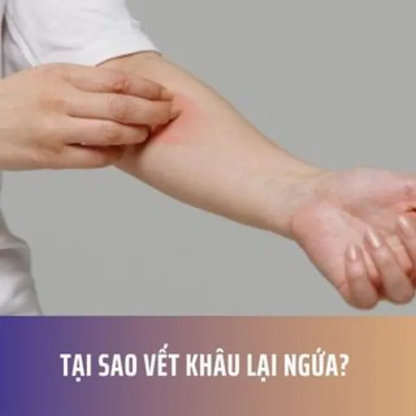 Tại Sao Vết Khâu Lại Ngứa?
