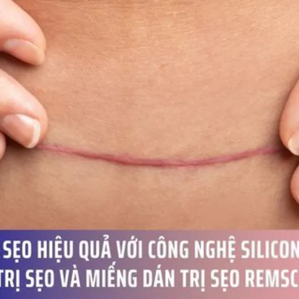 Giảm Sẹo Hiệu Quả với Công Nghệ Silicone Y Tế: Kem trị sẹo và Miếng dán trị sẹo RemScar®