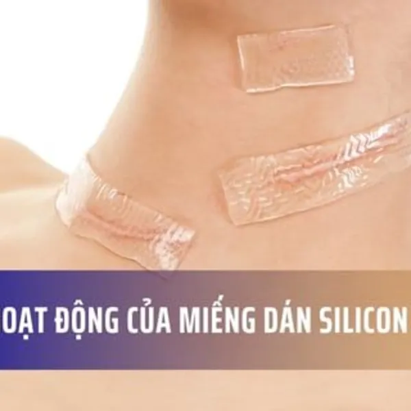 Cơ chế hoạt động của miếng dán silicon ép sẹo