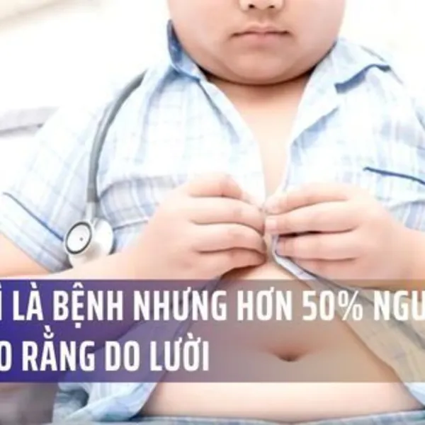 Béo phì là bệnh nhưng hơn 50% người Việt vẫn cho rằng do lười
