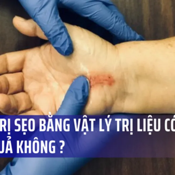Chữa trị sẹo bằng Vật lý trị liệu