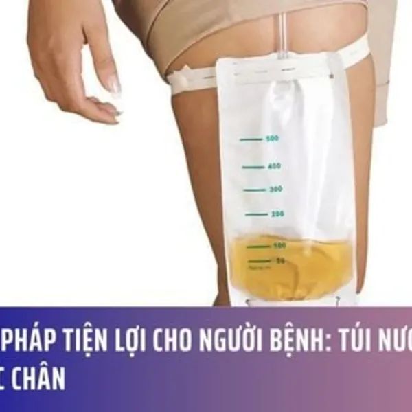 Giải Pháp Tiện Lợi Cho Người Bệnh: Túi Nước Tiểu Buộc Chân