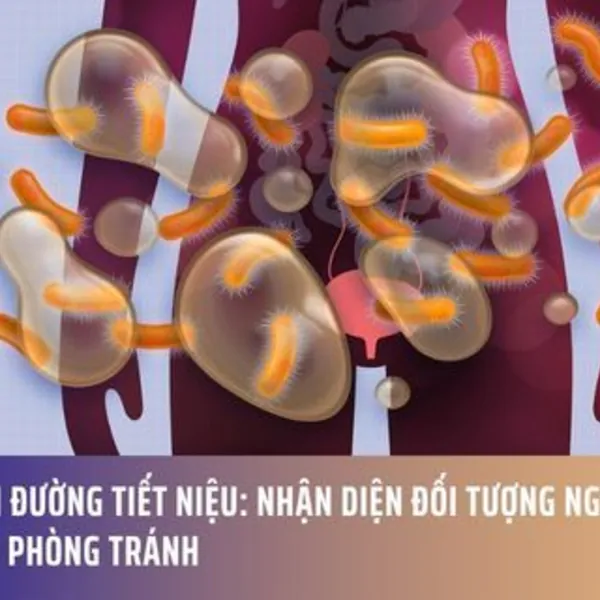 Viêm Đường Tiết Niệu: Nhận Diện Đối Tượng Nguy Cơ & Cách Phòng Tránh