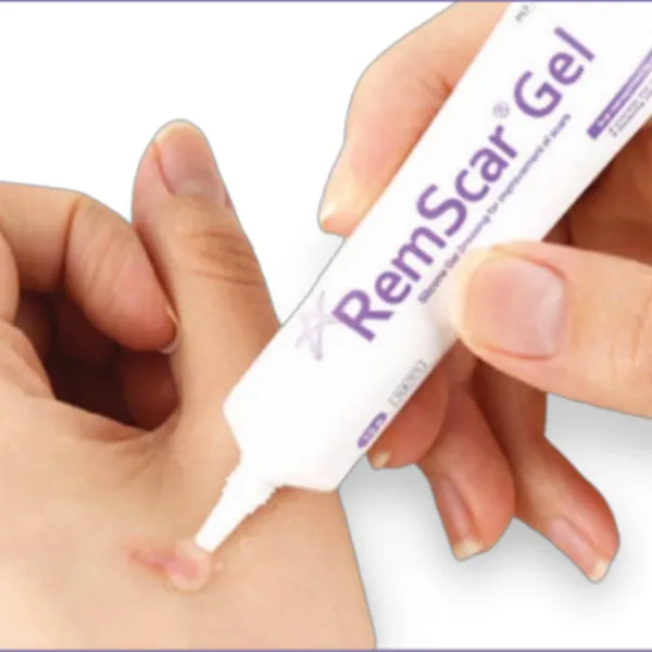 Hướng Dẫn Cách Sử Dụng Gel Silicon Trị Sẹo Hiệu Quả