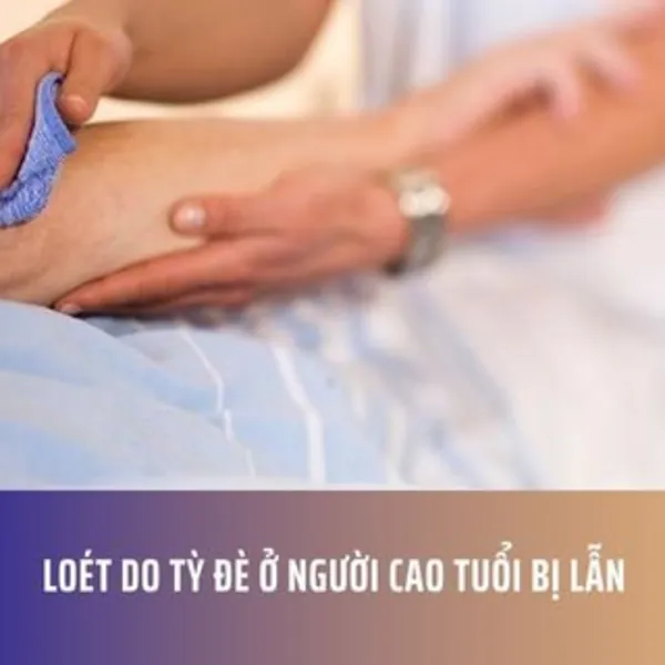 Loét do tỳ đè ở người cao tuổi bị lẫn