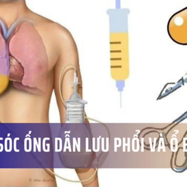 Chăm sóc ống dẫn lưu cho phổi và ổ bụng tại nhà
