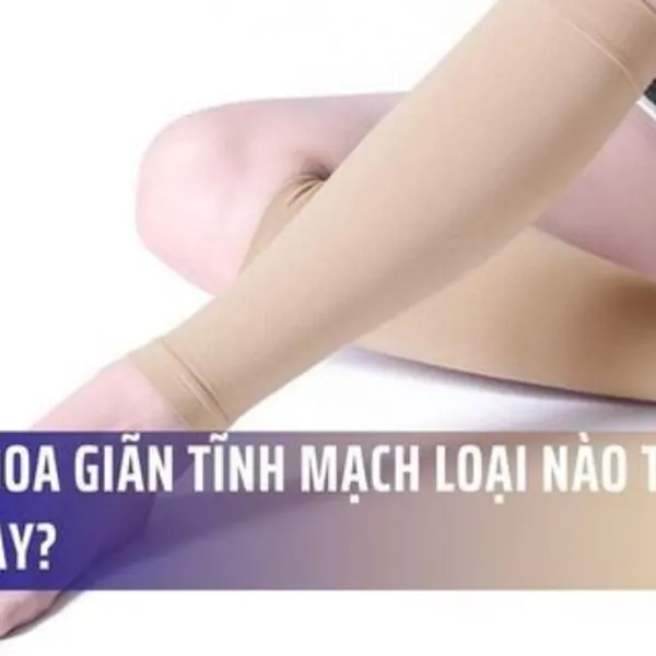 Vớ y khoa giãn tĩnh mạch loại nào tốt hiện nay?