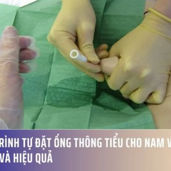 Quy Trình Tự Đặt Ống Thông Tiểu Cho Nam Và Nữ An Toàn Và Hiệu Quả