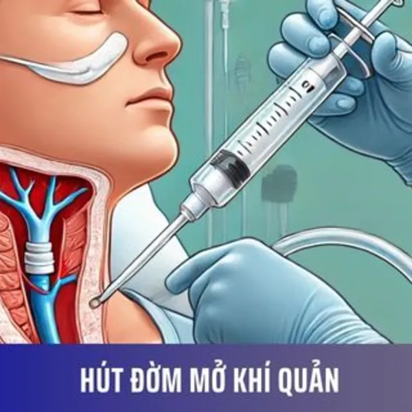 Hút đờm mở khí quản