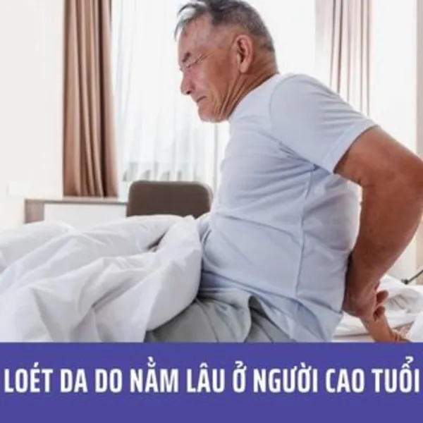 Loét da do nằm lâu ở người cao tuổi