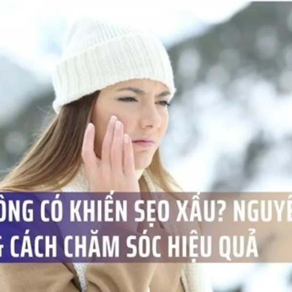 Mùa Đông Có Khiến Sẹo Xấu Hơn Không? Nguyên Nhân & Cách Chăm Sóc Hiệu Quả