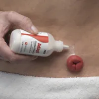 Bột hút ẩm chống loét hậu môn nhân tạo Hollister Adapt Stoma Power 7906